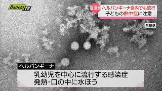 【夏風邪ヘルパンギーナ流行】子どもの熱中症に注意！　口内の痛みで水分がとりづらい場合も…（静岡県）