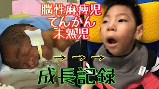 【脳性麻痺児　難治性てんかん　未熟児】NICU退院から２歳5ヶ月まで【成長記録】