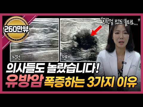 유방암이 폭증하는 진짜 이유? 유방암에 걸리지 않으려면 '이것'만큼은 꼭 알아두세요!