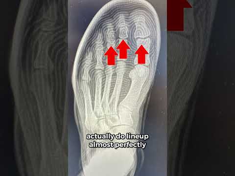 Kobe 9 Elite Protro On X-Ray Is Wild