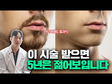 조금 아프지만 남자라면 무조건 추천하는 BEST 시술