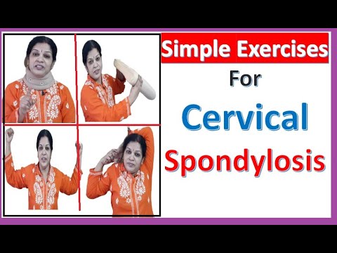 Home Remedies With Simple Exercises For Cervical Spondylosis