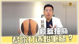 膝蓋抽脂 你有聽過嗎? 大腿抽脂 合併 膝蓋抽脂 雕塑鉛筆腿的關鍵!