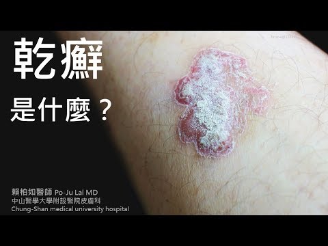 中山醫學大學附設醫院皮膚科 賴柏如醫師--"乾癬是什麼？" 衛教影片