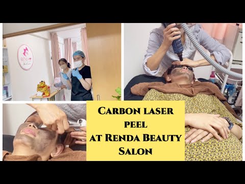 Carbon laser peel at Renda Beauty Salon|Reo king TV JAPAN