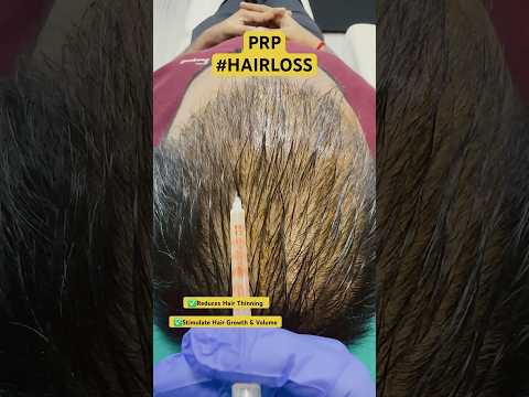 Best Hair Loss Treatments | Hair PRP | #shorts #hair #haircare #prp