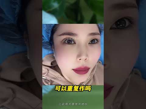 无痕筋膜提升变美快问快答！