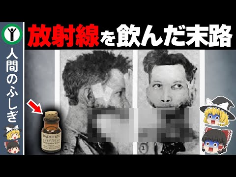 放射能を飲んだ末路【ゆっくり解説】