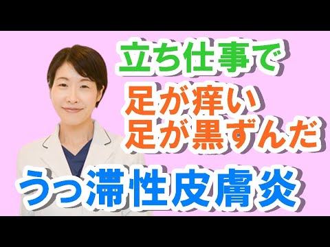 立ち仕事で足がかゆい、黒ずむ、うっ滞性皮膚炎の原因と治療【公式 やまぐち呼吸器内科・皮膚科クリニック】