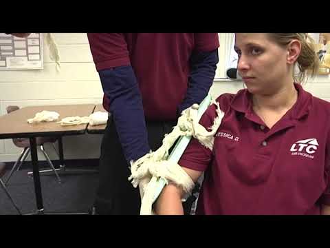 Arm (Humerus) Splinting