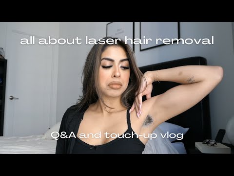 here’s the tea on full body laser hair removal.. | q&a and touch-up vlog