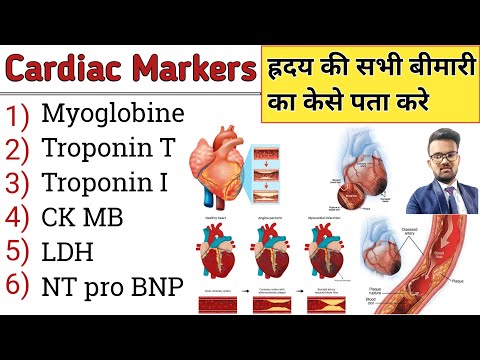 Cardiac Marker | Cardiac Profile Test | Heart Problems | Heart attack | Heart Disease | Cardiac