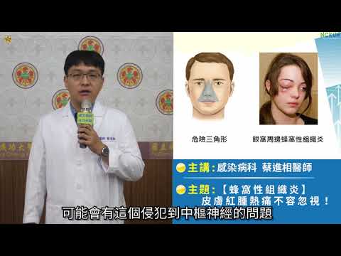 【蜂窩性組織炎】皮膚紅腫熱痛不容忽視！/蔡進相醫師