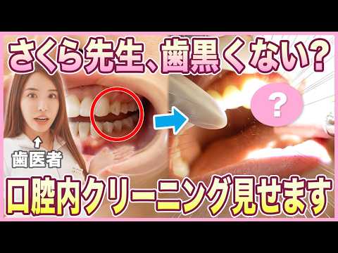 さくら先生の着色をクリーニング！【歯医者｜エアフロー｜着色｜黒ずみ】