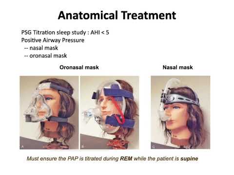 進階臨床醫學20210505 sleep apnea syndrome