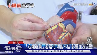 提高警覺! 「瓣膜性心臟病」輕忽這些症狀...死亡風險高｜十點不一樣20220121