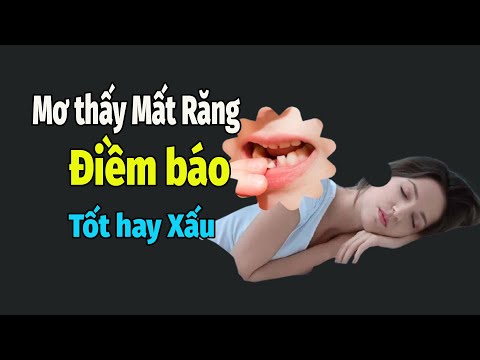 Mơ Thấy Mất Răng: Có Phải Dấu Hiệu Xấu