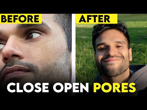 Open Pores Solution - Natural vs Chemical Skin Care Routine | ❌ Clogged Pores | BeYourBest Skincare