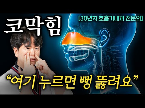 막힌 코 10초만에 뚫리는 신비한 자세. 코 막혀서 잠 못 잘 땐 이렇게 하세요 (진성림 원장 2부)