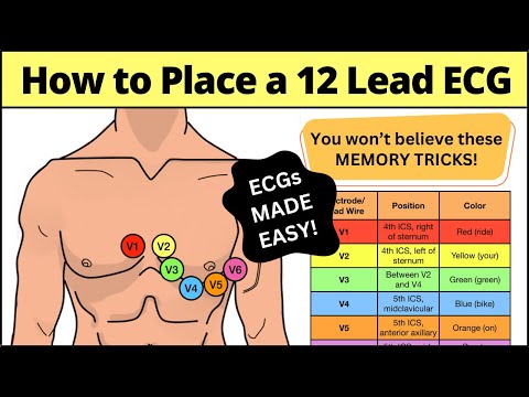 12 Lead ECG Placement MADE EASY [EMT, Nursing, Paramedic] #ecg #nursing