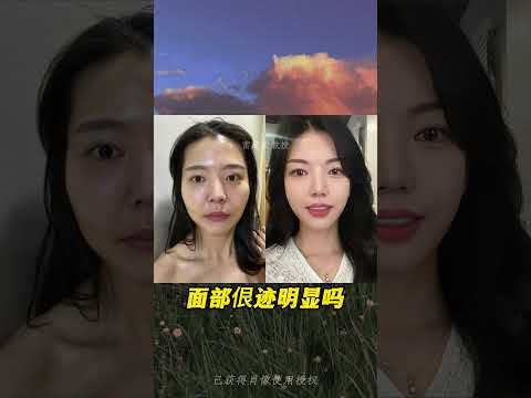 无痕筋膜提升变美快问快答！