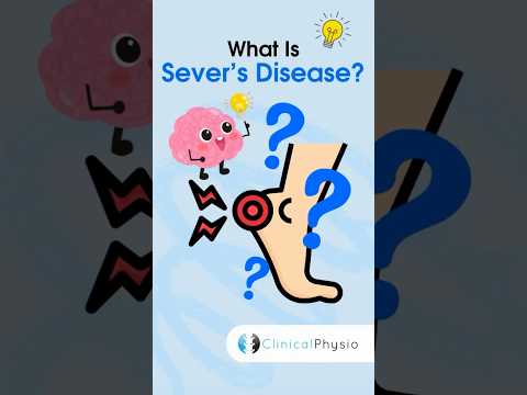 Sever’s Disease #physicaltherapy #physiotheraphy