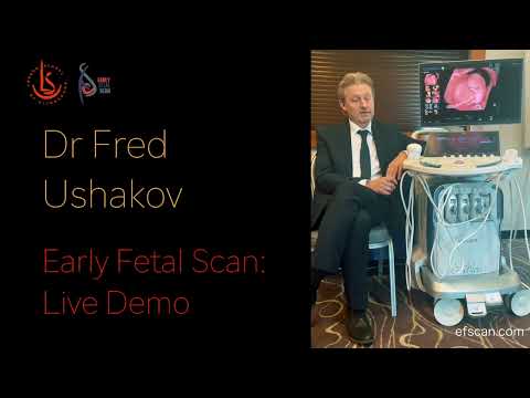 Dr Fred Ushakov - Early Fetal Scan Live DEMO - VOLUSON Expert 22