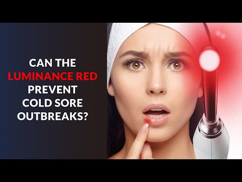 Can the Luminance RED Prevent Cold Sore Outbreaks? (Cold Sore Laser Treatment)