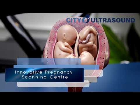 City Ultrasound: Innovative Pregnancy Scan Centre in the Heart of London