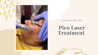 Pico Laser Treatment For Melasma LIVE!