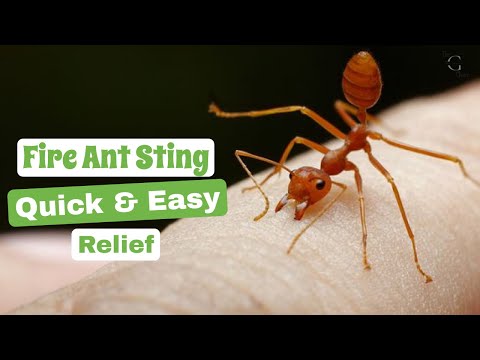 Fire Ant Sting Relief: How to Treat and Soothe the Pain - Quick & Easy | The Guardians Choice