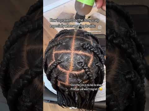 How to prevent/stop itching scalp #braids #hairgrowthoil #haircare #itchyscalp #hairgrowth