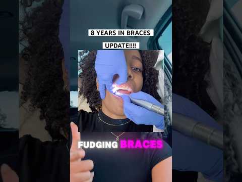 Braces Update | Braces Vlog 2024 #shortsfeed #braces #ortho