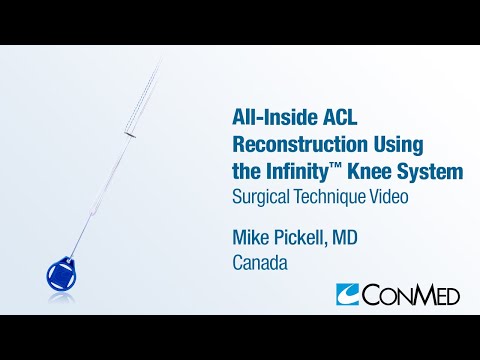 Dr. Mike Pickell - All-Inside ACL Reconstruction Using the Infinity™ Knee System - CONMED Technique