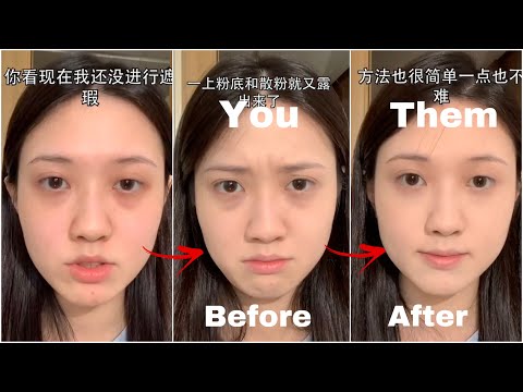 HOW TO REMOVE DARK CIRCLES In The Most Effective Way!! Step By Step ~Makeup Hacks from China