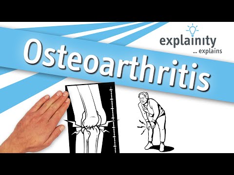 Osteoarthritis explained (explainity® explainer video)