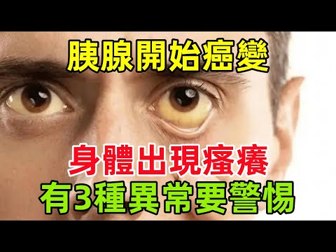 胰腺開始癌變，身體出現瘙癢？醫生告誡：若有3種異常，要警惕#健康常識#養生保健#健康#健康飲食