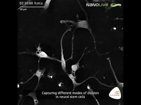 Capturing different modes of division in neural stem cells