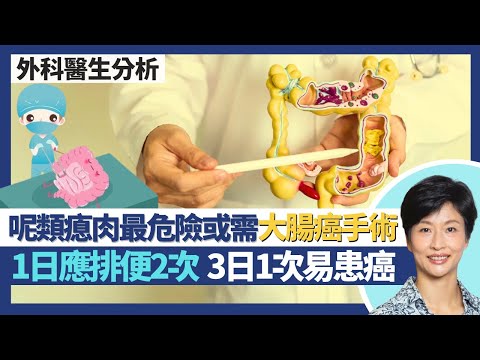 大腸癌治療｜大腸鏡切瘜肉已可完成治療 唯獨擔心有一類瘜肉或要做手術？類固醇係手術剋星 1%滲漏風險急升至逾50%！1日排便2次先正常 3日1次較易患癌？｜王建芳醫生 外科醫生楊丕祥醫生｜人類健康研究所