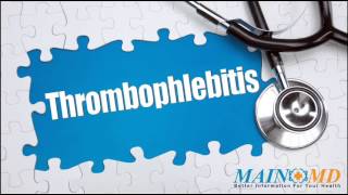 Thrombophlebitis ¦ Treatment and Symptoms