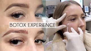 UNDER EYE BOTOX Experience & Footage | Before/After, Cost, Pain, Bruising