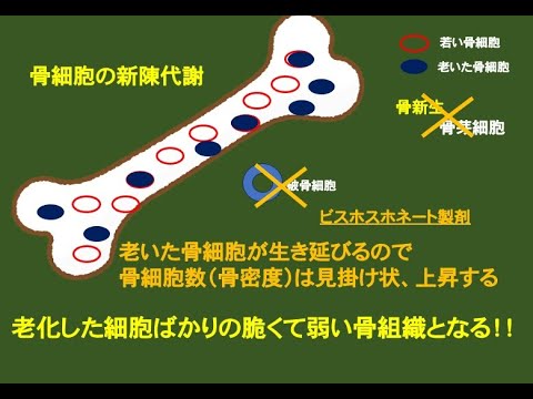 骨粗鬆症の治療を検証する