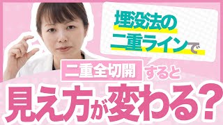 埋没法の二重ラインで全切開をすると見え方が変わる？