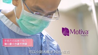 Motiva魔滴隆乳 | Motiva魔滴隆乳假體材質說明 | 腋下Motiva魔滴隆乳切口個案解說分析Dr 吳孟頴