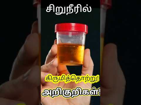 #urineinfection | #urineproblem | #urinaryinfection | #urineinfectiontamil | #urineproblemintamil