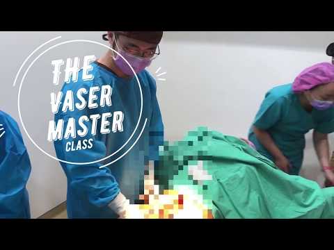 the Vaser master 4 大師課第四堂