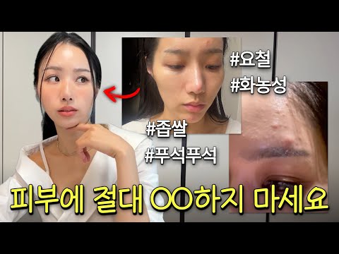 🥚광고X🥚000 했더니 피부가 좋아졌어요🧼 문제성 피부가 좋아진 피부 습관•제품•관리 모음🧖‍♀️💅