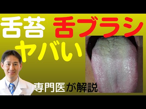 舌苔をとるための舌磨きは絶対止めよう。舌苔は皮膚の垢と同じ。