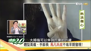 夏季熱心氣衰 心臟病猝死率增加一倍 健康2.0