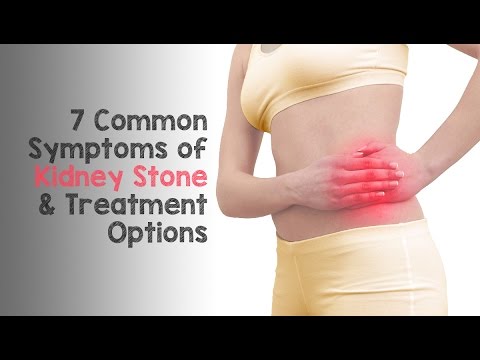 Symptoms of Kidney Stone - Dr. Nicholas Laryngakis